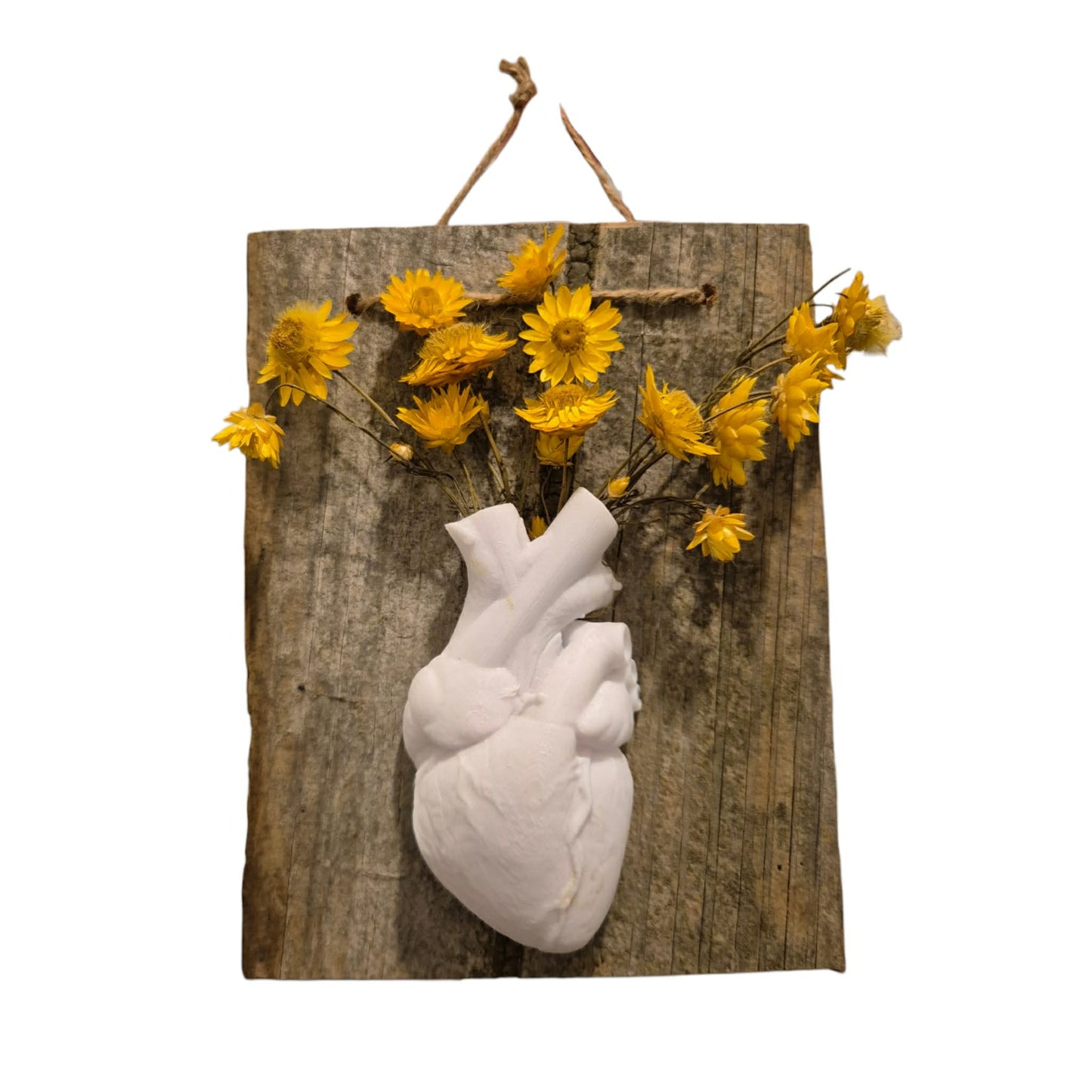 Anatomical Heart Vase